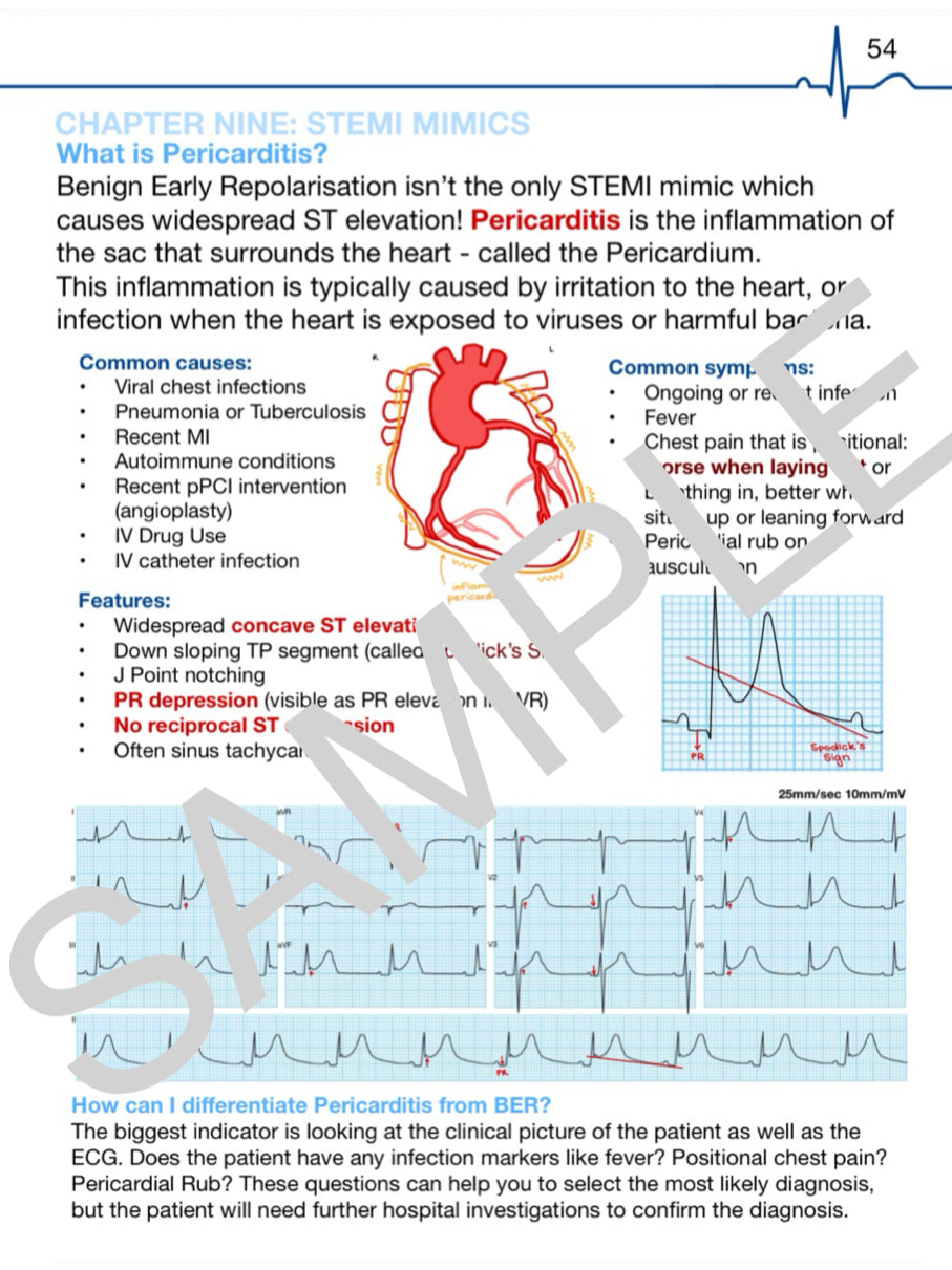 (eBooks) COMPLETE ECG SERIES: Book One & Two
