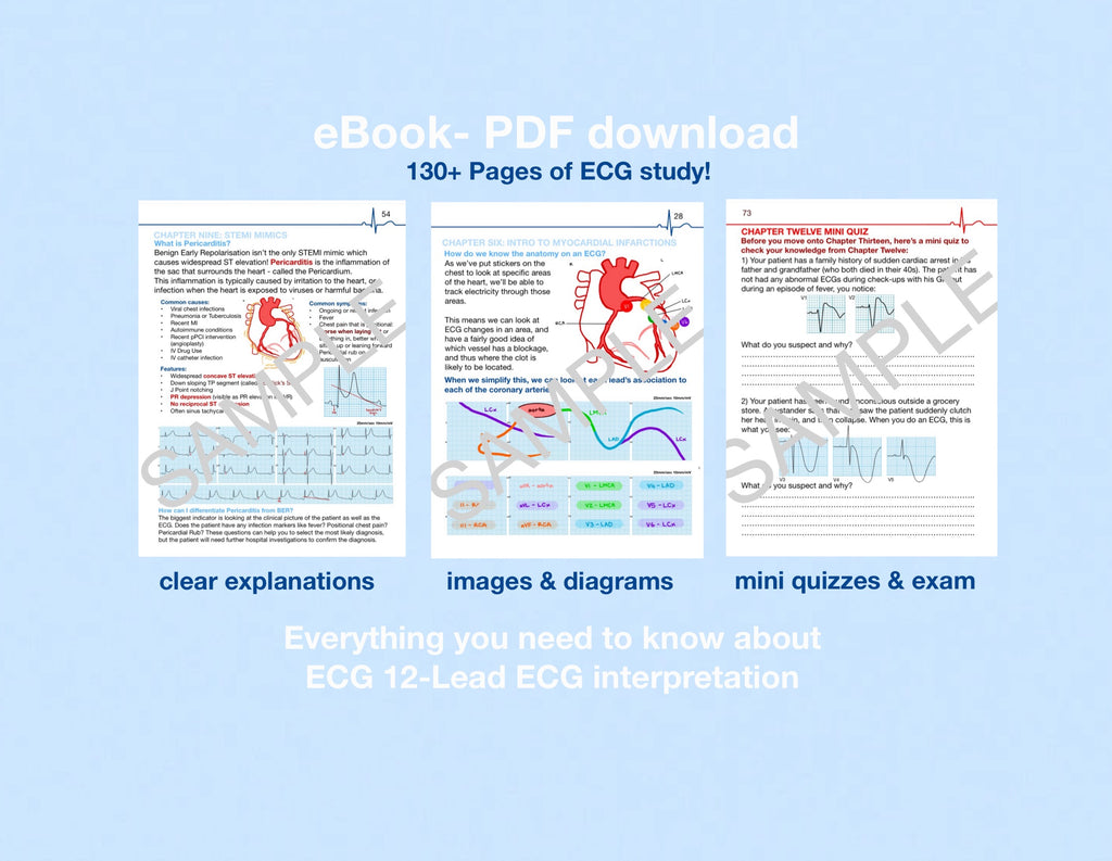 (eBooks) COMPLETE ECG SERIES: Book One & Two