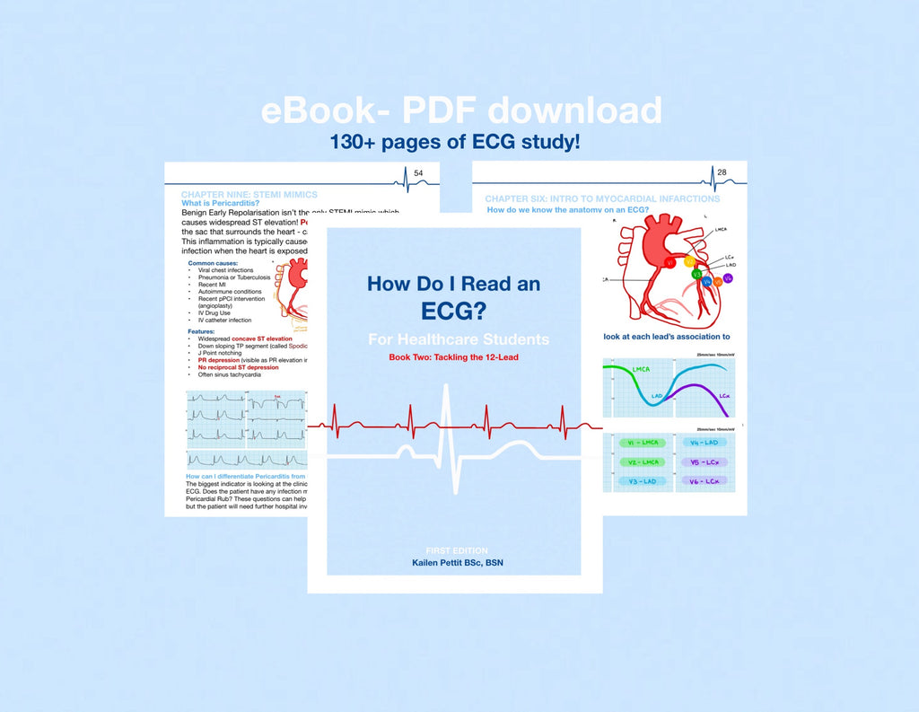 (eBooks) COMPLETE ECG SERIES: Book One & Two