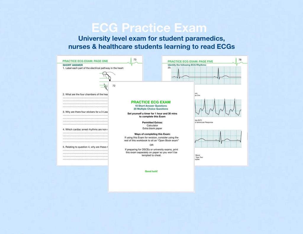 (PDF) ECG Rhythms Practice Exam + Worked Answers