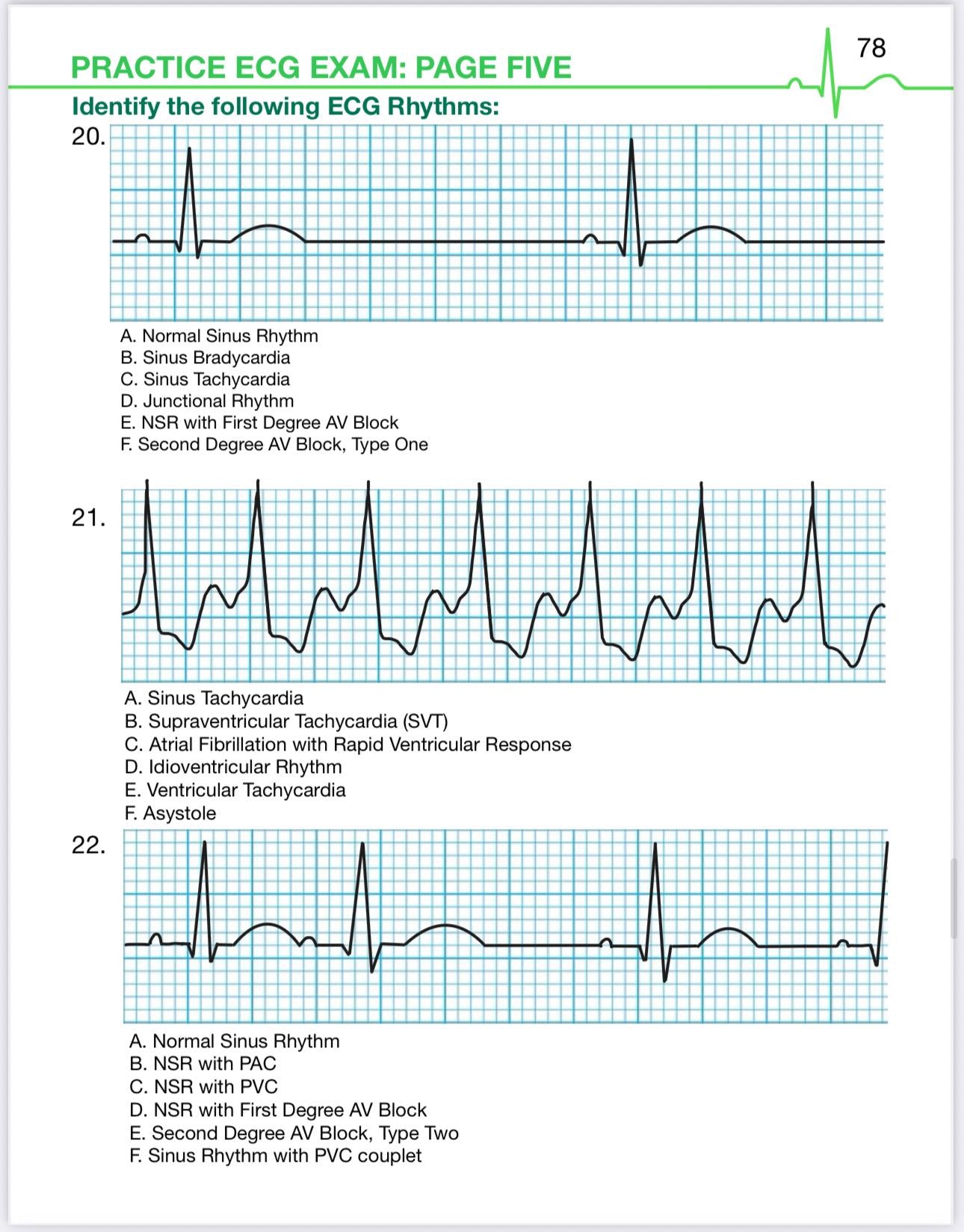 (PDF) ECG Rhythms Practice Exam + Worked Answers