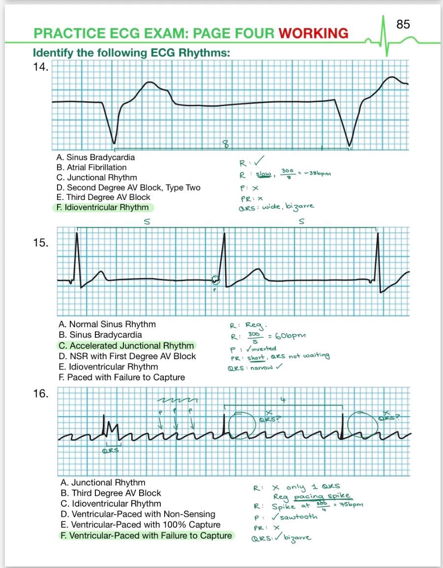 (PDF) ECG Rhythms Practice Exam + Worked Answers